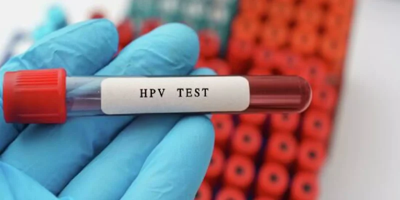 HPV Testi Fiyati