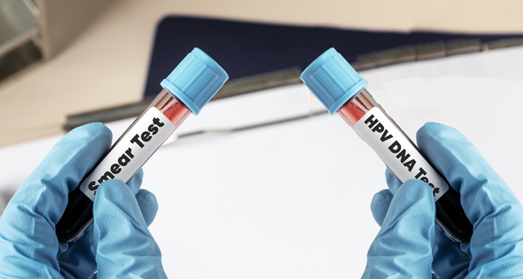 HPV testi